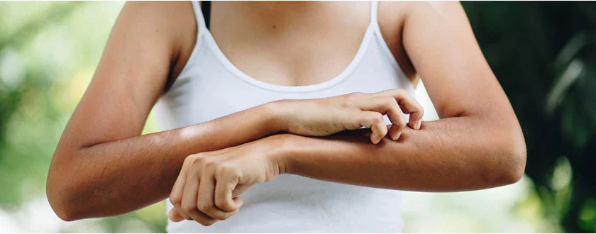 ¿Cómo protegerse de los mosquitos este verano?